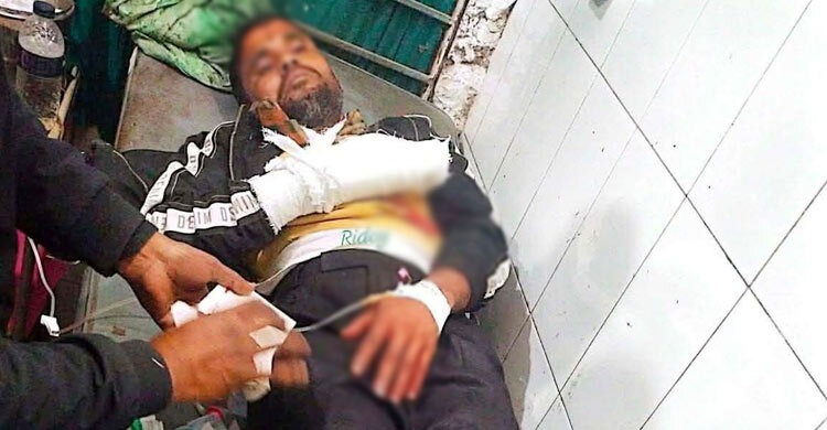 গাইবান্ধায় দুর্বৃত্তের হামলায় যুবদলকর্মীর আঙুল বিচ্ছিন্ন