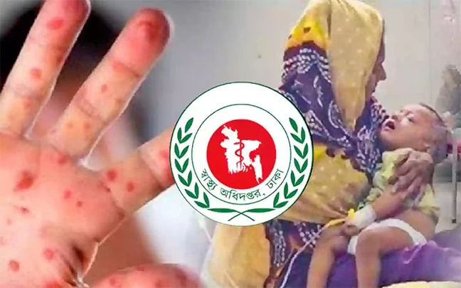 হাম পরিস্থিতি স্বাভাবিক হতে লাগবে আরও দুই-তিন সপ্তাহ