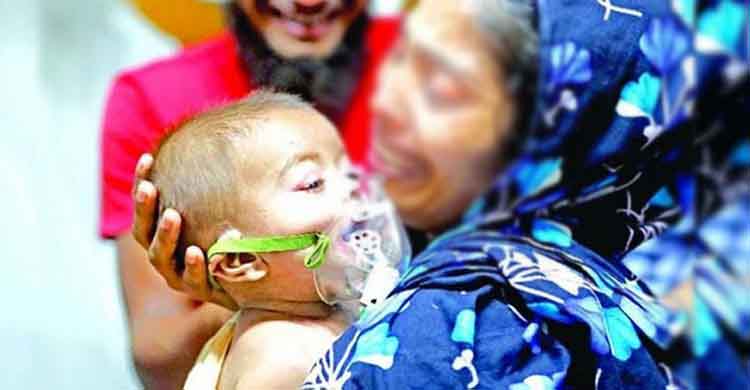 ২৪ ঘণ্টায় হামের উপসর্গে আরও ৭ শিশুর মৃত্যু
